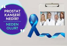 Prostat Kanseri Nasıl Tedavi Edilir?