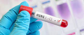 H1N1 Virüsü Nedir 