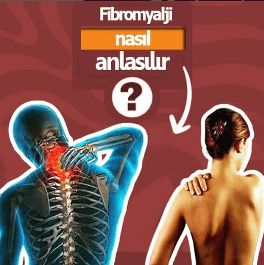 Fibromyalji tedavisi nasıl olur? 