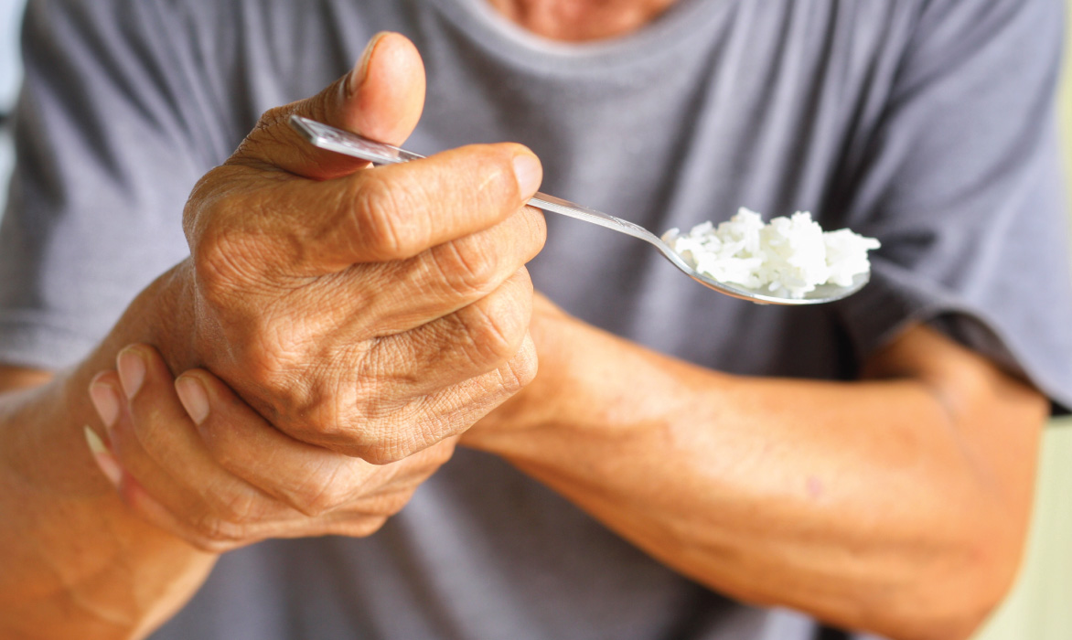 Parkinson Hastalığının Evreleri Nelerdir?