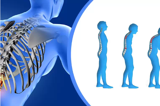 Osteoporoz belirtileri nelerdir?