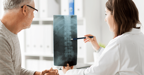 Osteoporoz kimlerde görülür?