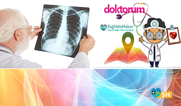 Göğüs Hastalıkları Doktor Rehberi-Doktorum (M Harfi)