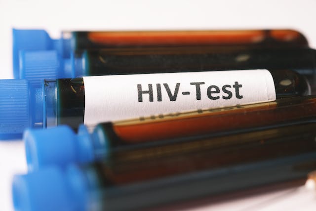 HIV Türkiye’de Neden Böyle Hızla Yayılıyor?