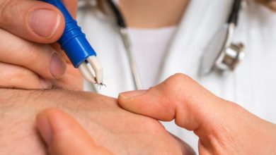 Kene Isırdığında Neler Yapılmalı? Neler Yapılmamalı?