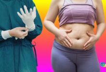 Karın Germe Estetiği Hakkında Tüm Merak Ettikleriniz