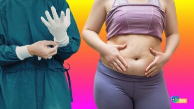 Karın Germe Estetiği Hakkında Tüm Merak Ettikleriniz