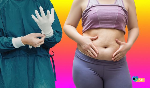 Karın Germe Estetiği Hakkında Tüm Merak Ettikleriniz